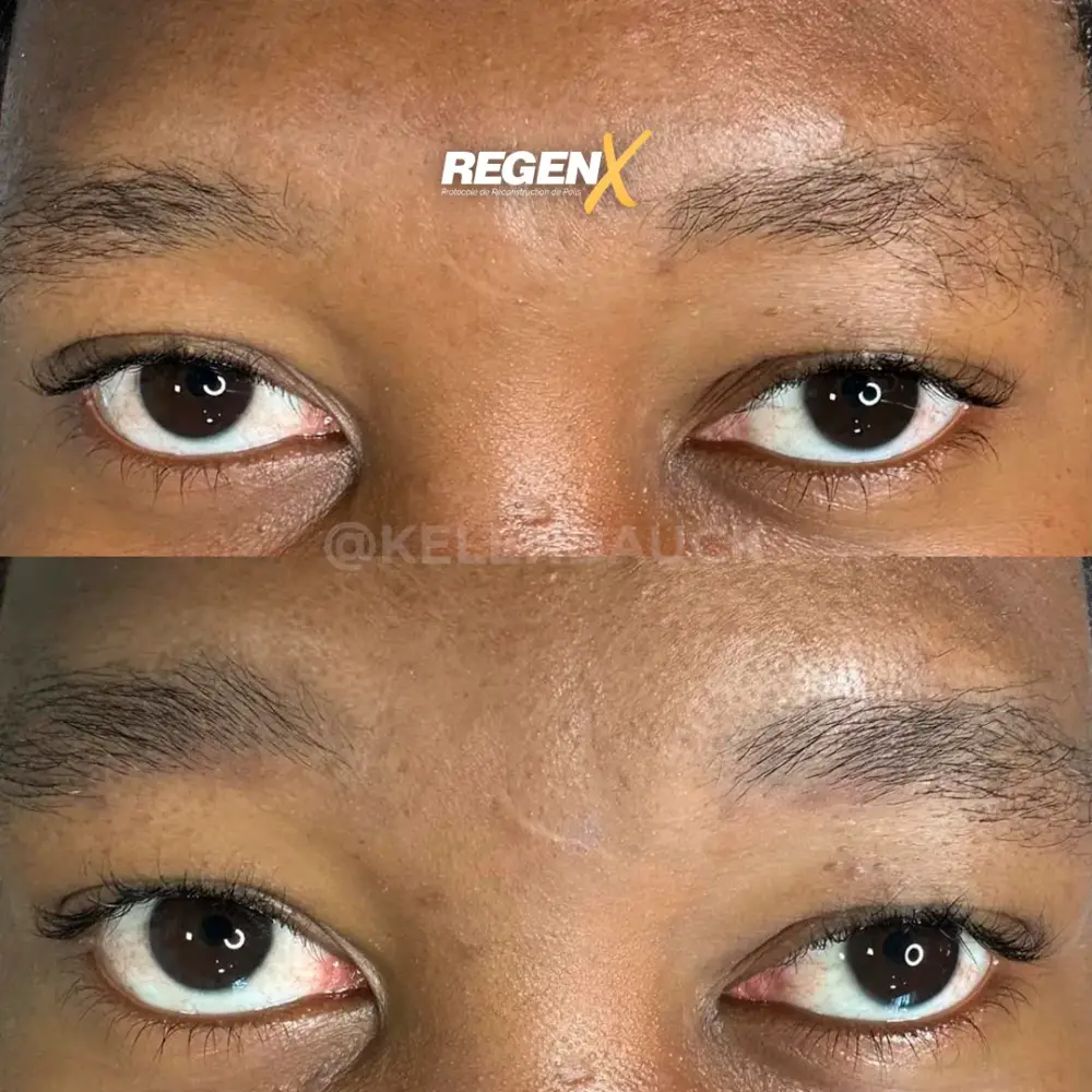 [2]-[REGENX]-[SOURCIL]