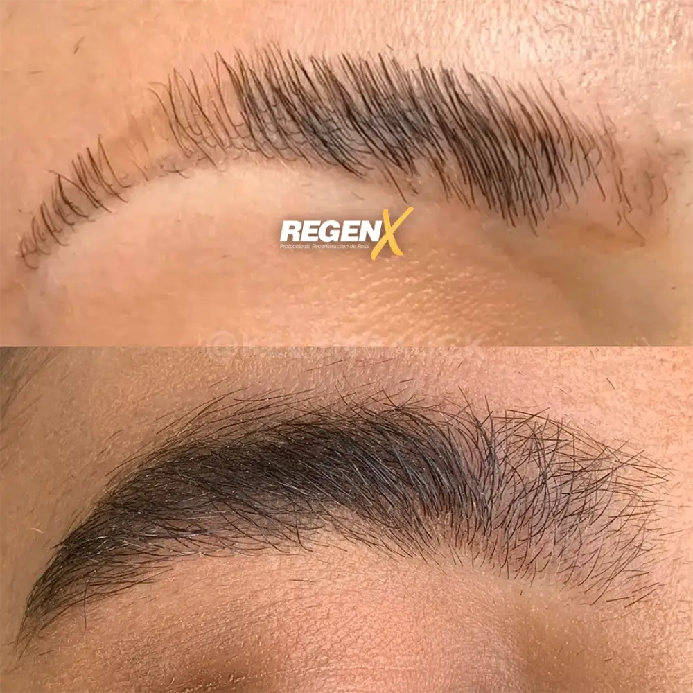 [3]-[REGENX]-[SOURCIL]