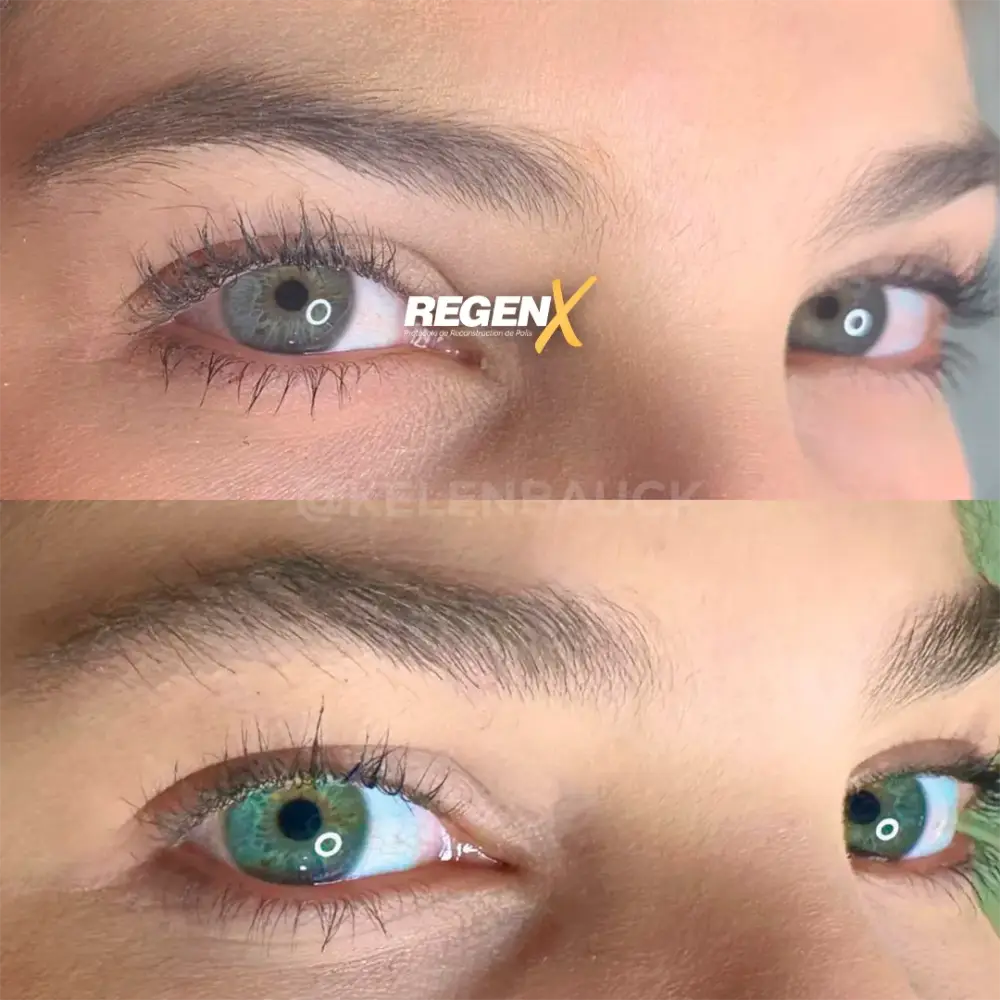[4]-[REGENX]-[SOURCIL]
