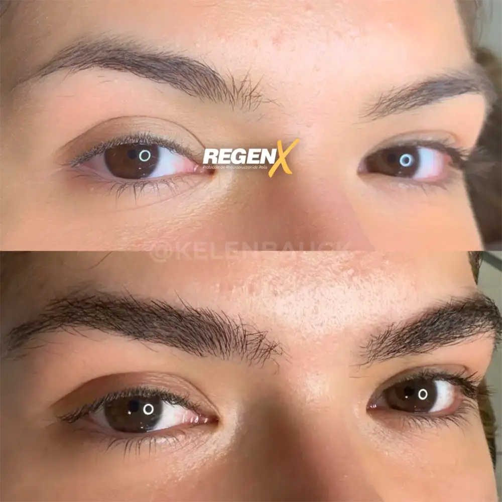 [5]-[REGENX]-[SOURCIL]