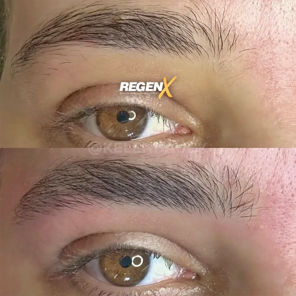 [6]-[REGENX]-[SOURCIL]