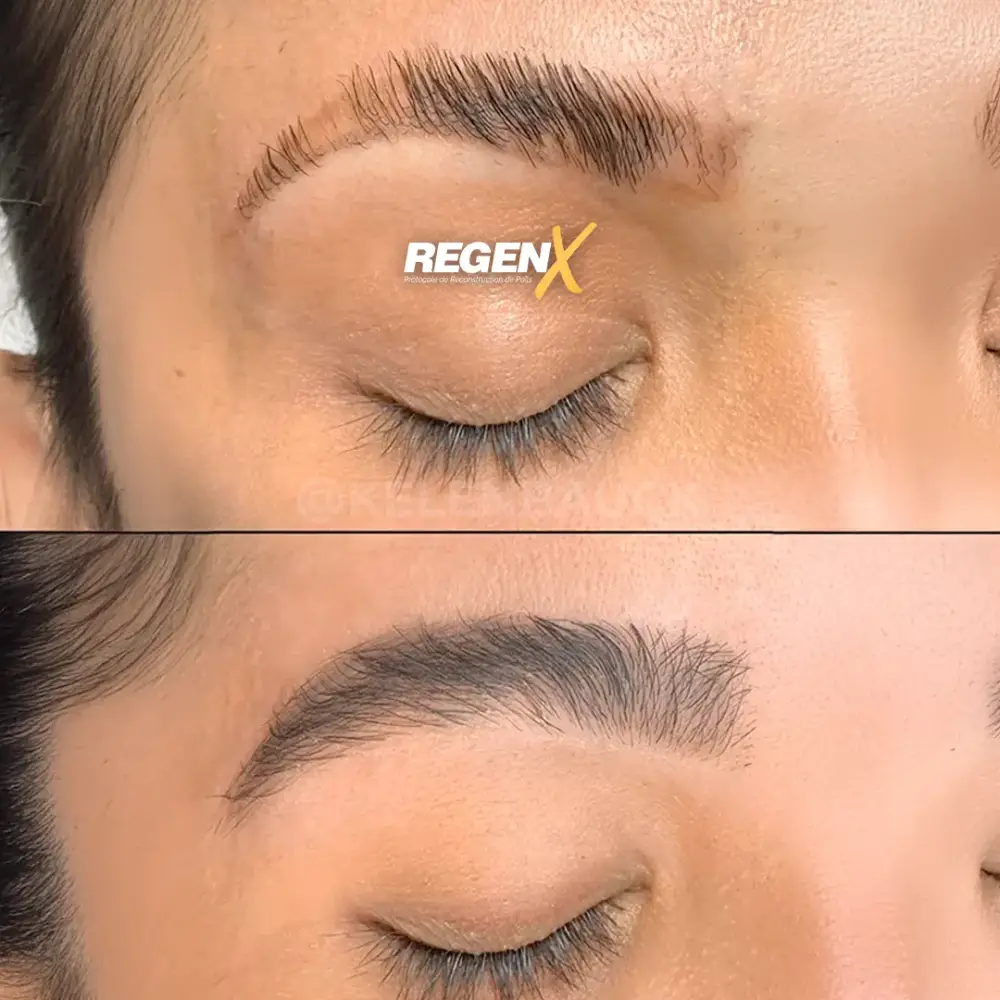 [8]-[REGENX]-[SOURCIL]