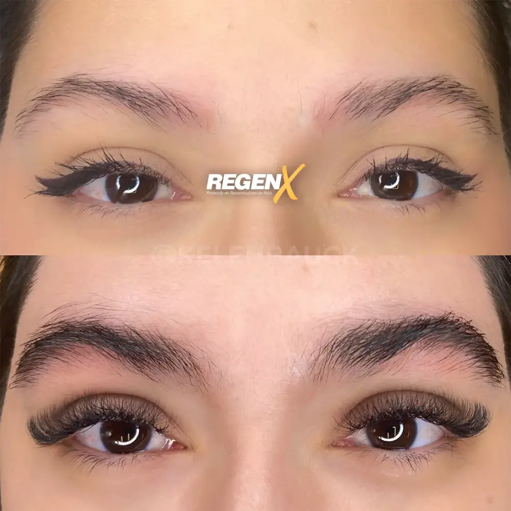 [9]-[REGENX]-[SOURCIL]
