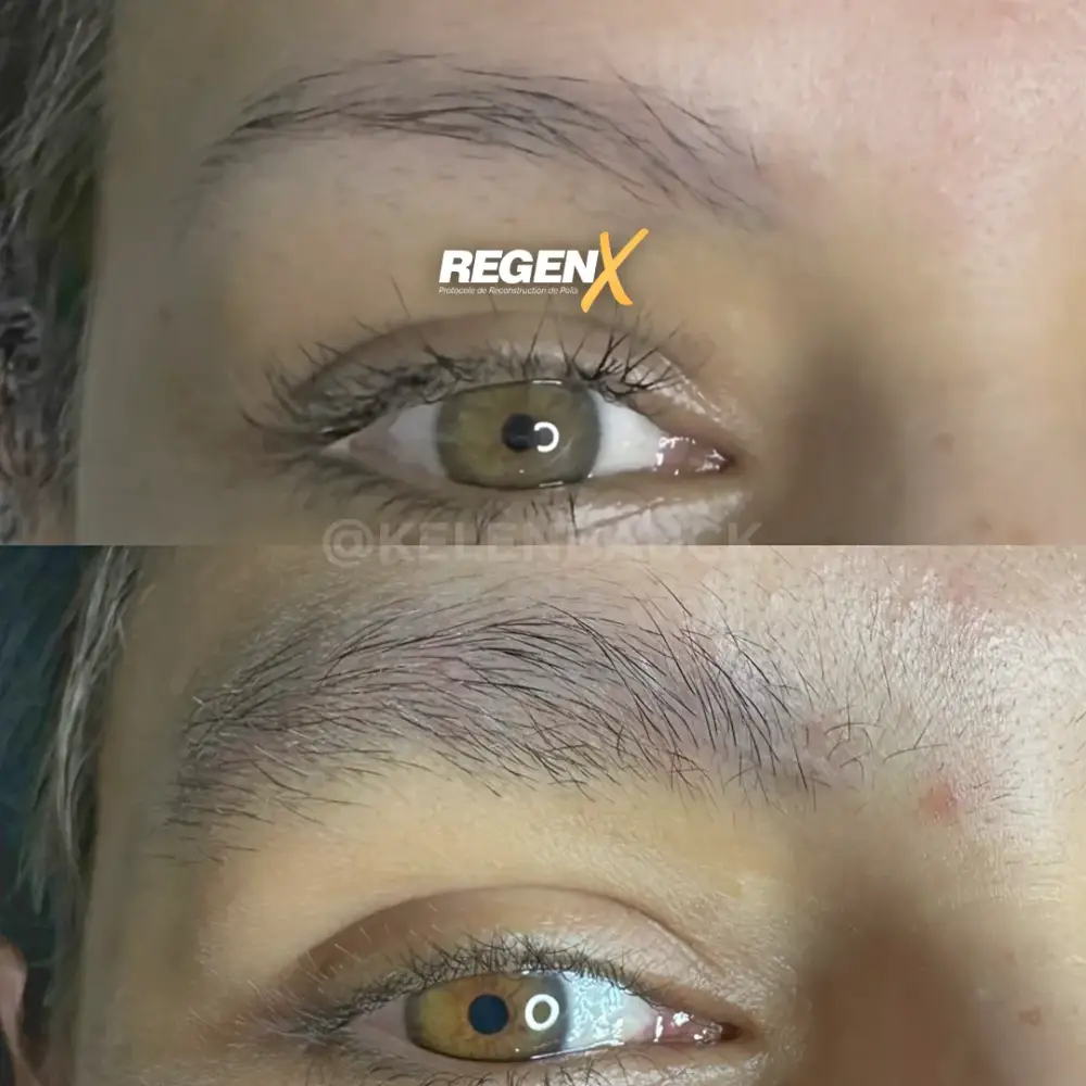 [10]-[REGENX]-[SOURCIL]