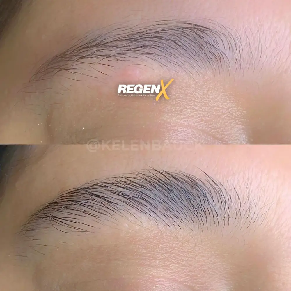 [11]-[REGENX]-[SOURCIL]