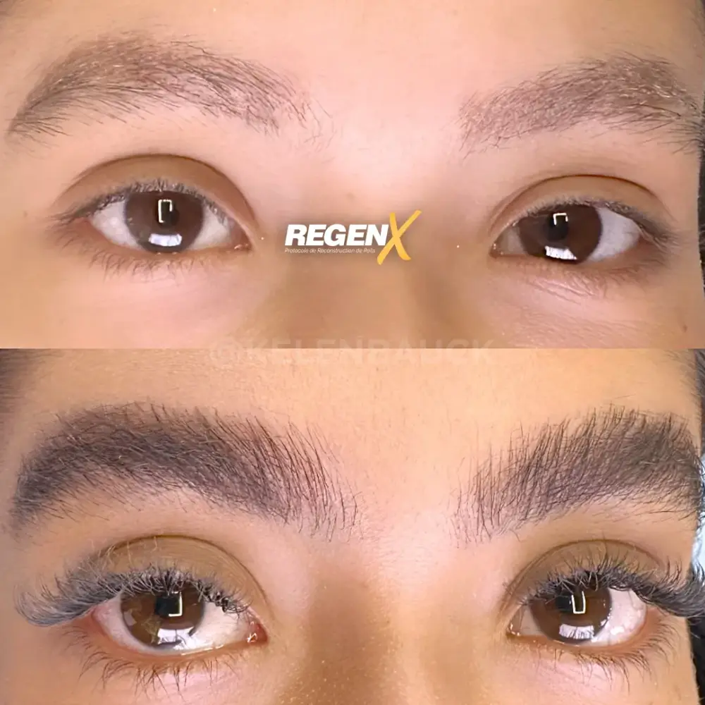 [12]-[REGENX]-[SOURCIL]