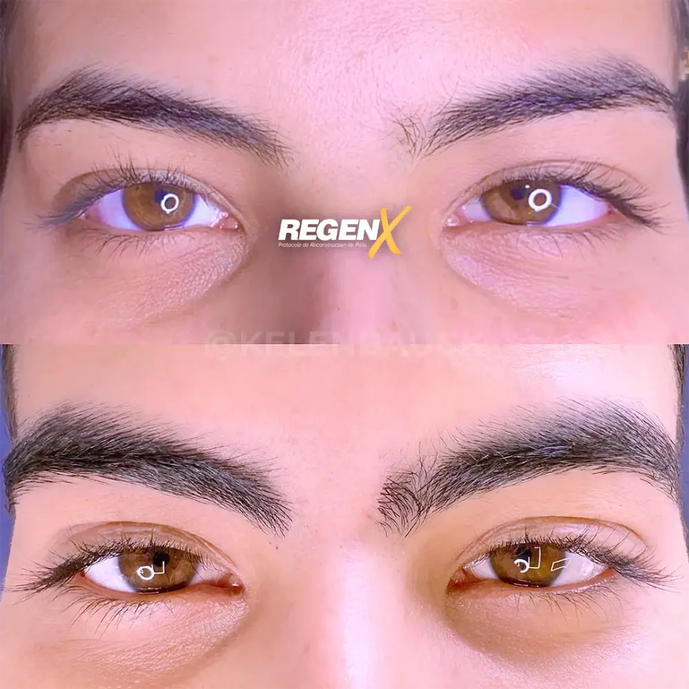 [13]-[REGENX]-[SOURCIL]