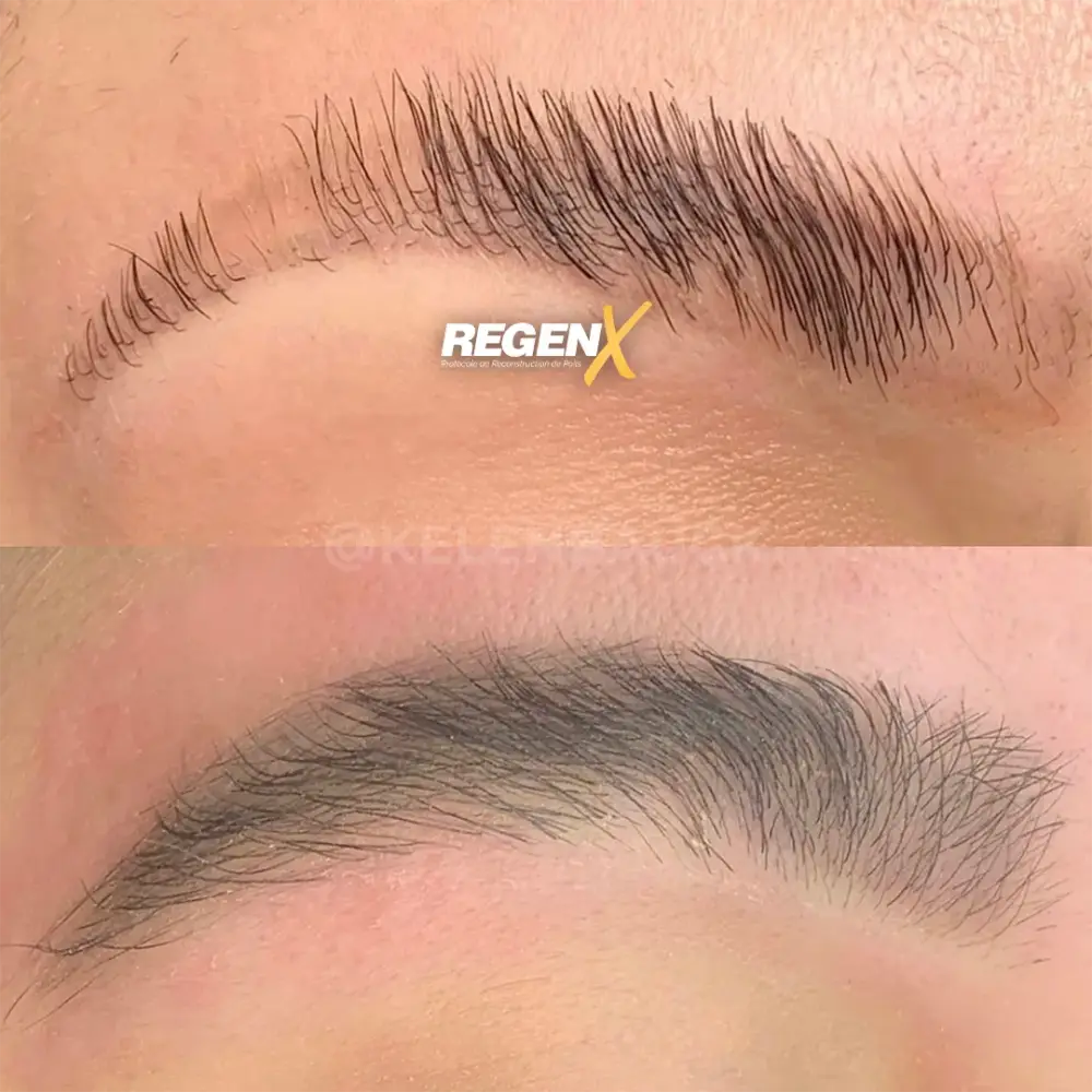 [1]-[REGENX]-[SOURCIL] (1)
