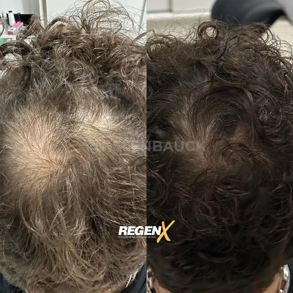 [9]-[REGENX]-[CHEVEUX]