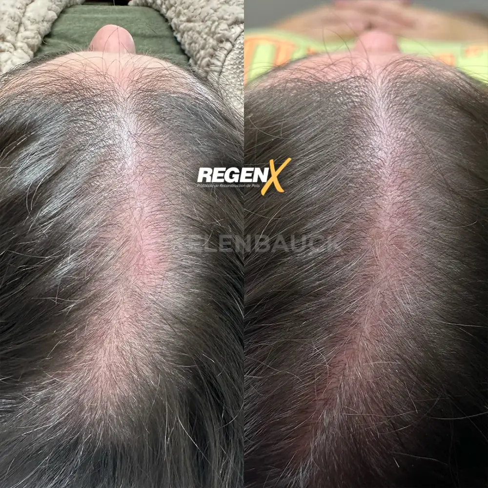 [1]-[REGENX]-[CHEVEUX]