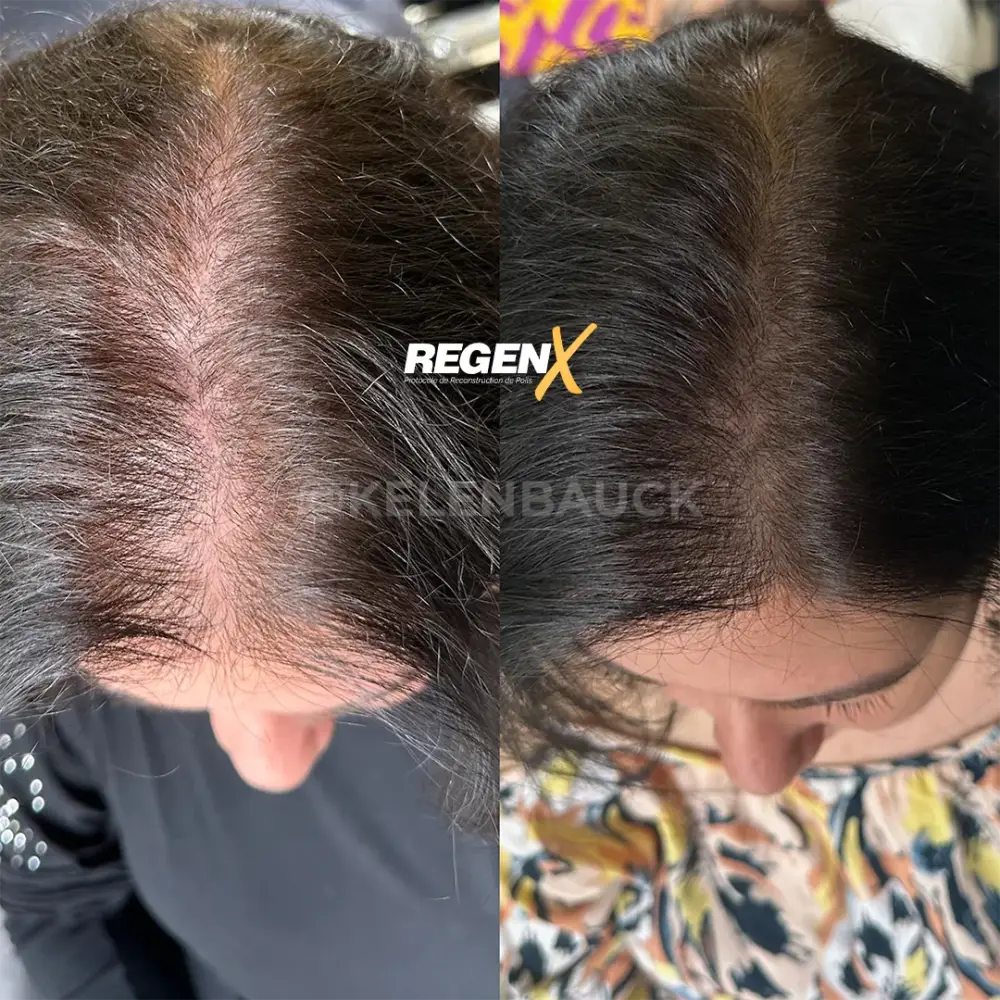 [2]-[REGENX]-[CHEVEUX]
