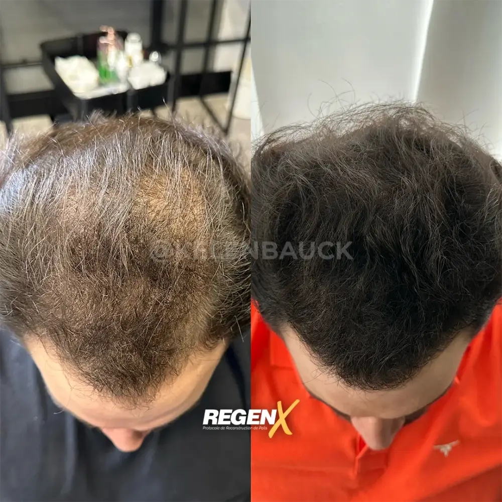 [3]-[REGENX]-[CHEVEUX]
