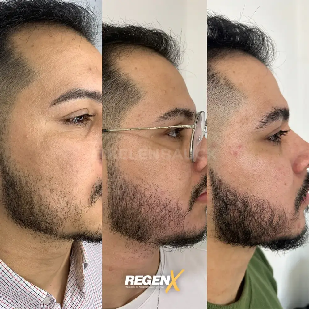 [1]-[REGENX]-[BARBE] (1)